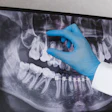 Dental X Ray