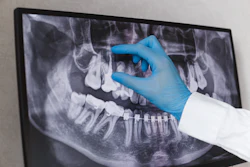 Dental X Ray
