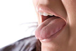 Tongue