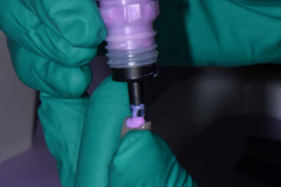 Figure 2: Placement of Ivoclean (Ivoclar) to cleanse the restoration and remove contaminants.
