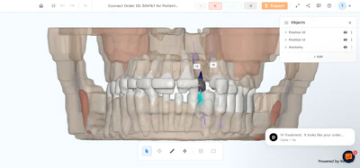 3D dental treatment plan showing teeth alignment with orthodontic annotations and jaw anatomy model