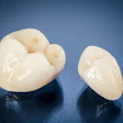 Two ceramic dental crowns lie on a glossy black surface.