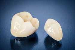 Two ceramic dental crowns lie on a glossy black surface.