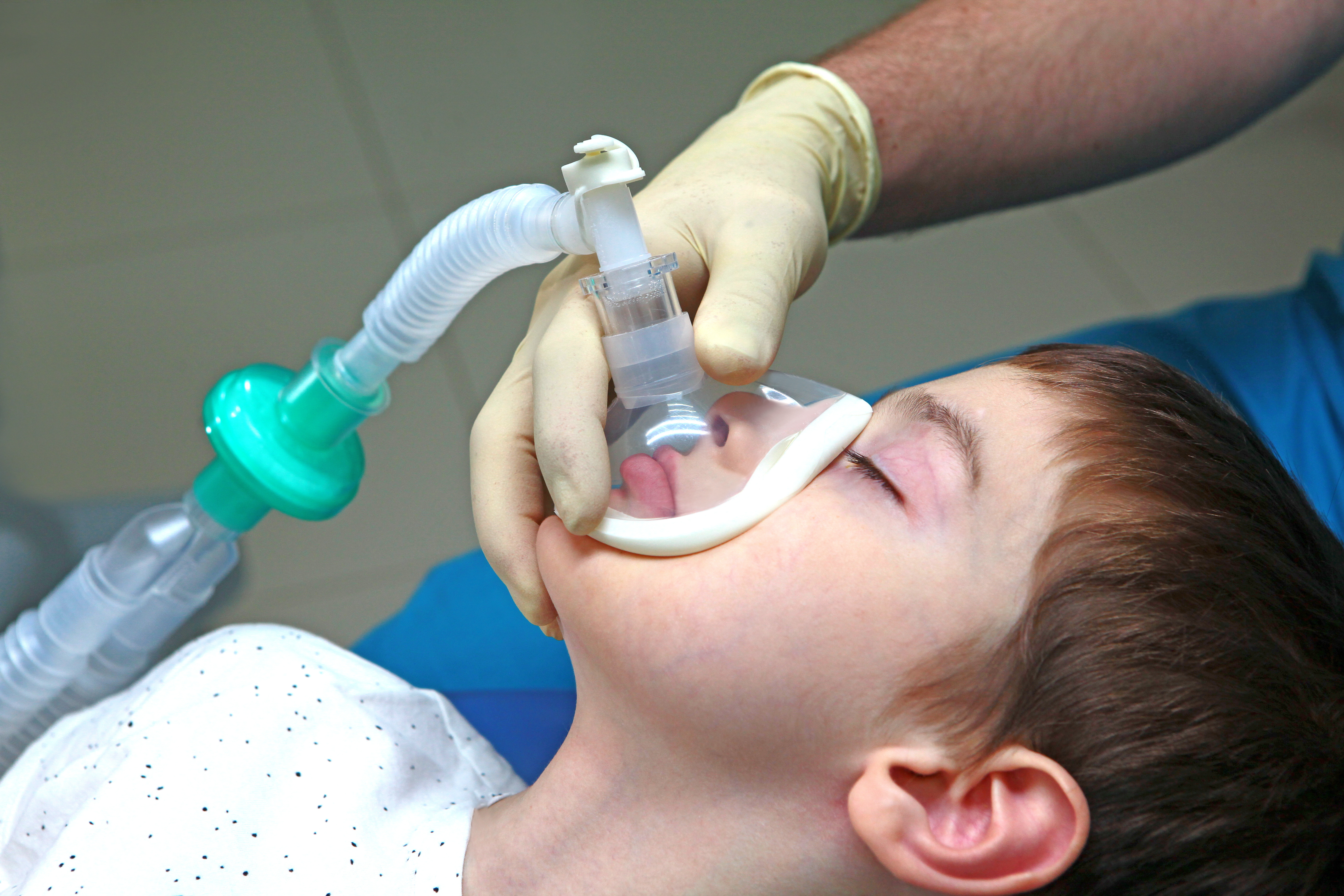 A child has his eyes closed as an anesthesia mask is placed over his nose and mouth.